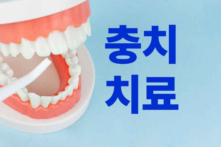 충치치료 하지마세요
