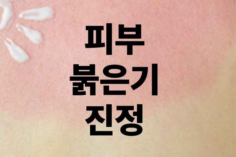 피부 붉은기 진정