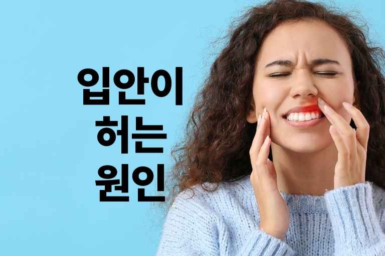 입안이 허는 원인